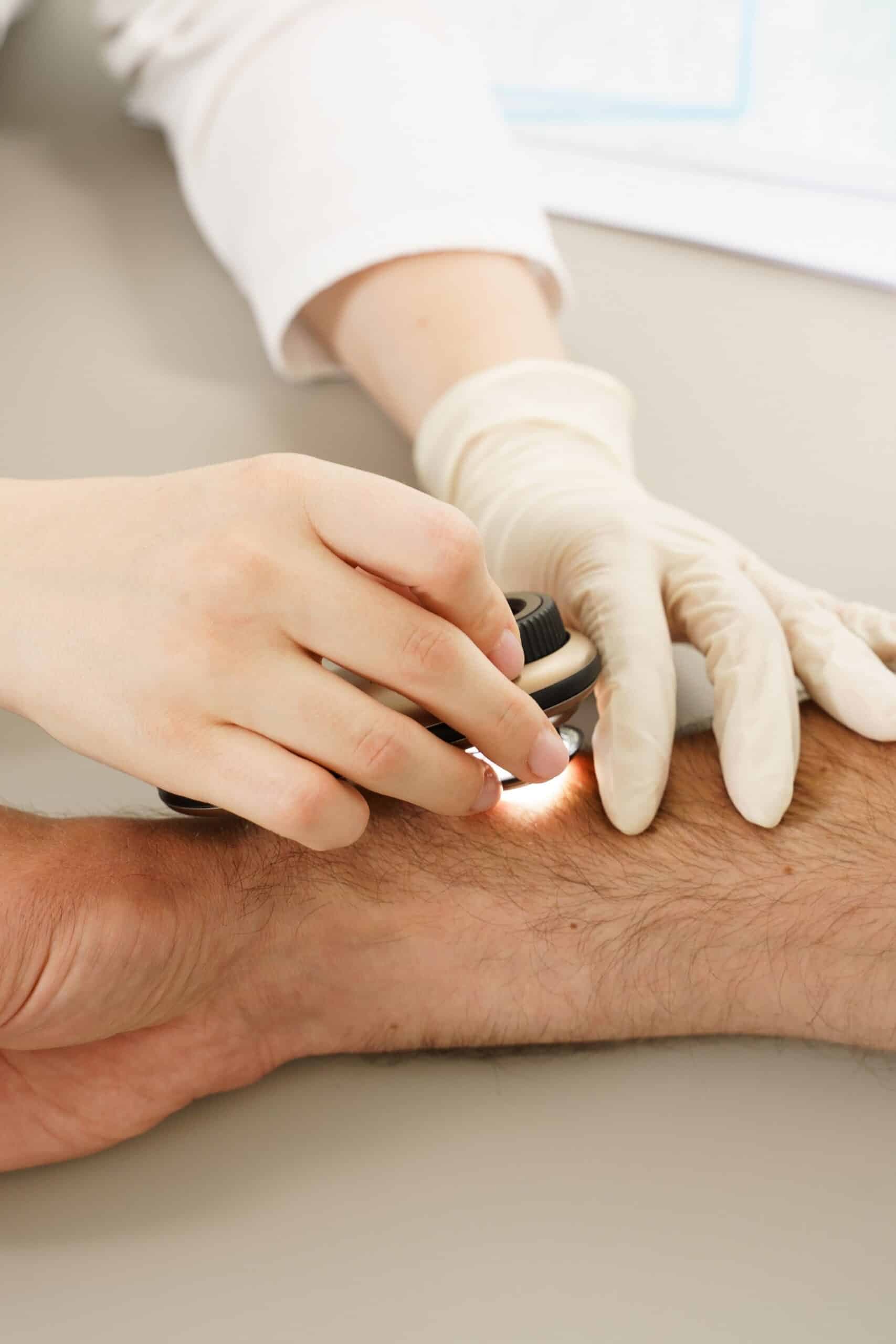 Doctor assessing a possible melanoma